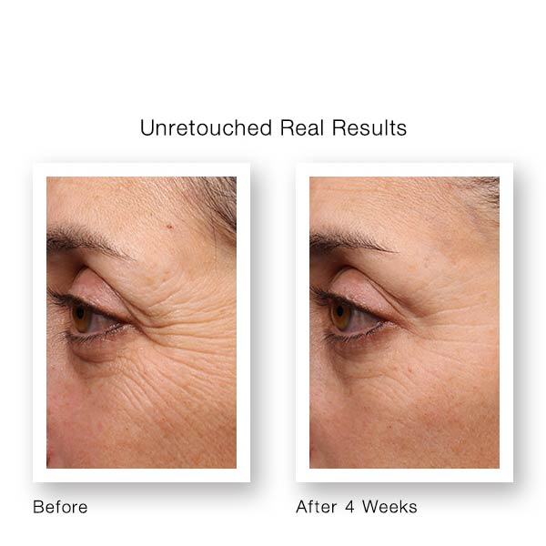 Murad Resurgence Retinol Youth Renewal Eye Serum