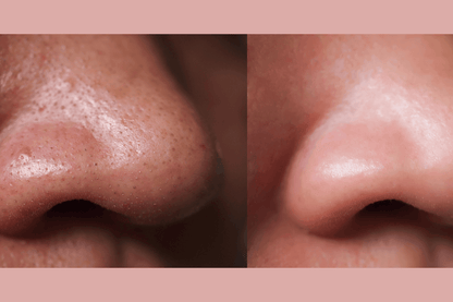 Gymsegbë - Ultra-Advanced Anti-Aging Daily Resurfacing Pads
