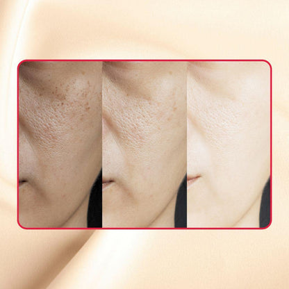 Gymsegbë - Thick As Thieves Pure Glycolic Acid Lactic Acid Extreme Gel Peel - 30ml