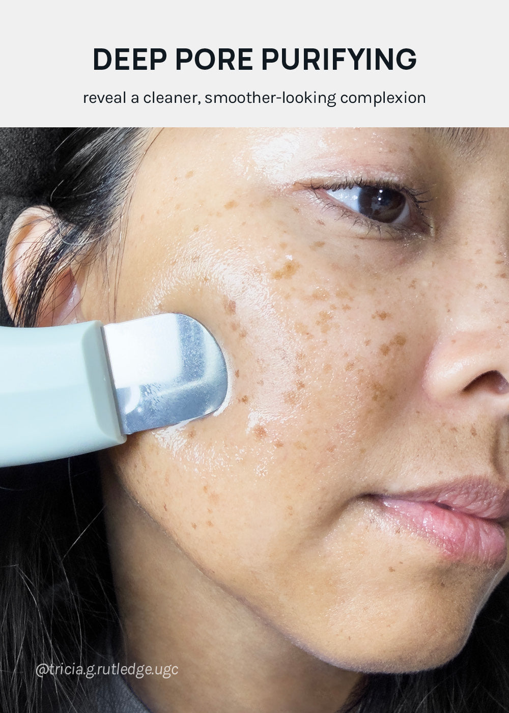 AOA Skin Pore Care Pro