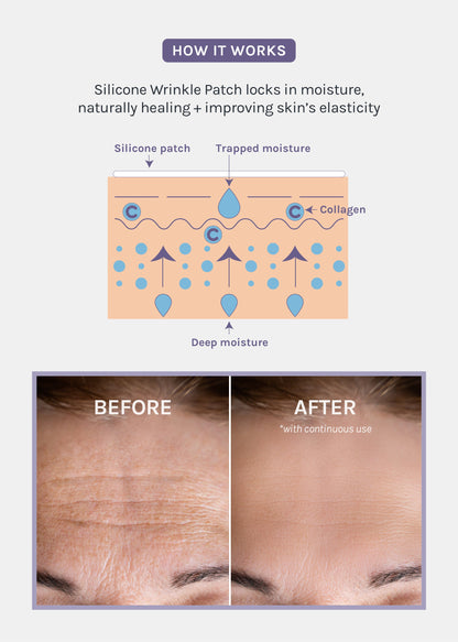 AOA Skin Wrinkle Smoothing Patches – Smile Line