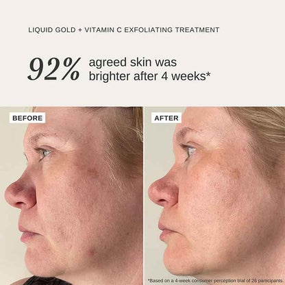 Alpha-H Liquid Gold Exfoliating Treatment with 5% Glycolic Acid and Vitamin C 100ml