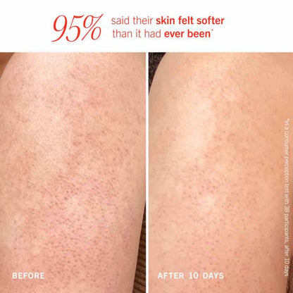 First Aid Beauty KP Bump Eraser Body with 10% AHA - Peach Scent