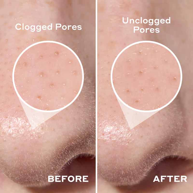 Mario Badescu 2-in-1 Deep Cleansing Pore Strips