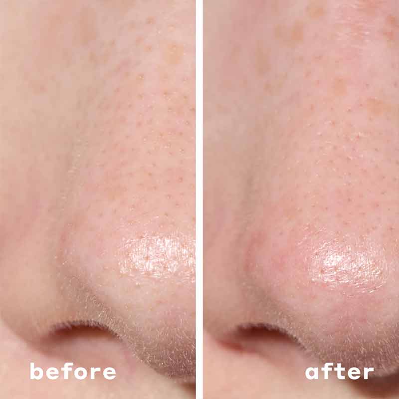 Mario Badescu 2-in-1 Deep Cleansing Pore Strips